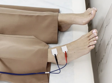 Биоимпедансометрия