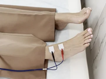 Биоимпедансометрия